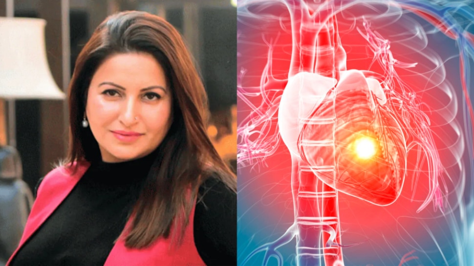 Heart Attack In Women: इस वजह से दुनिया को अलविदा कह गईं सोनाली फोगाट, महिलाएं रखें इन लक्षणों पर पैनी नजर