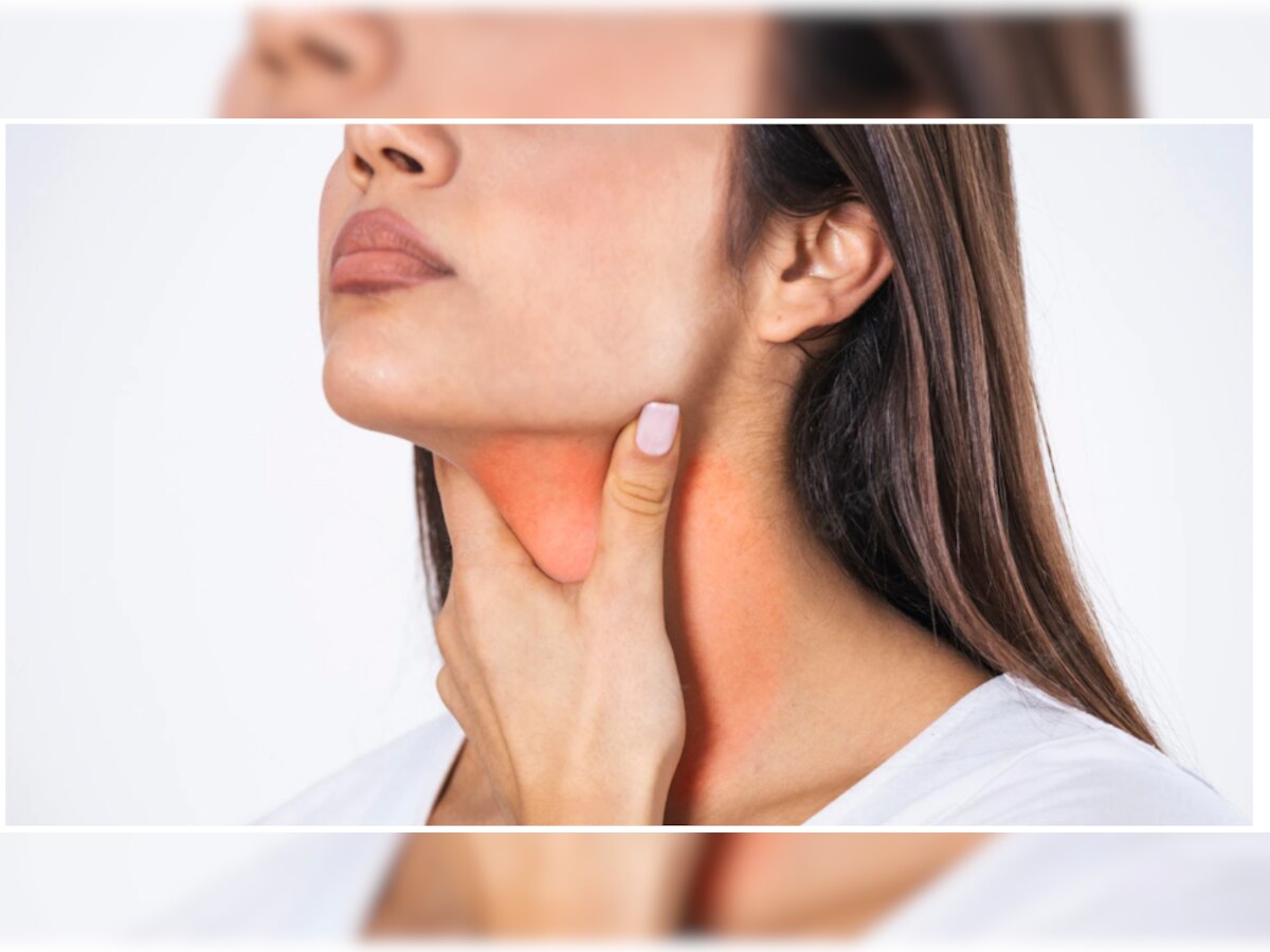 Hyperthyroidism