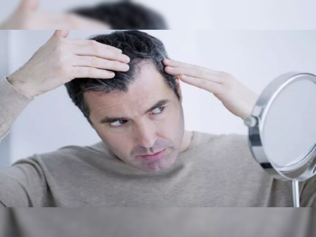 Hair Care Tips: बिना मेहंदी लगाएं इस तरह बालों को करें काला, वाइट हेयर की समस्या होगी दूर