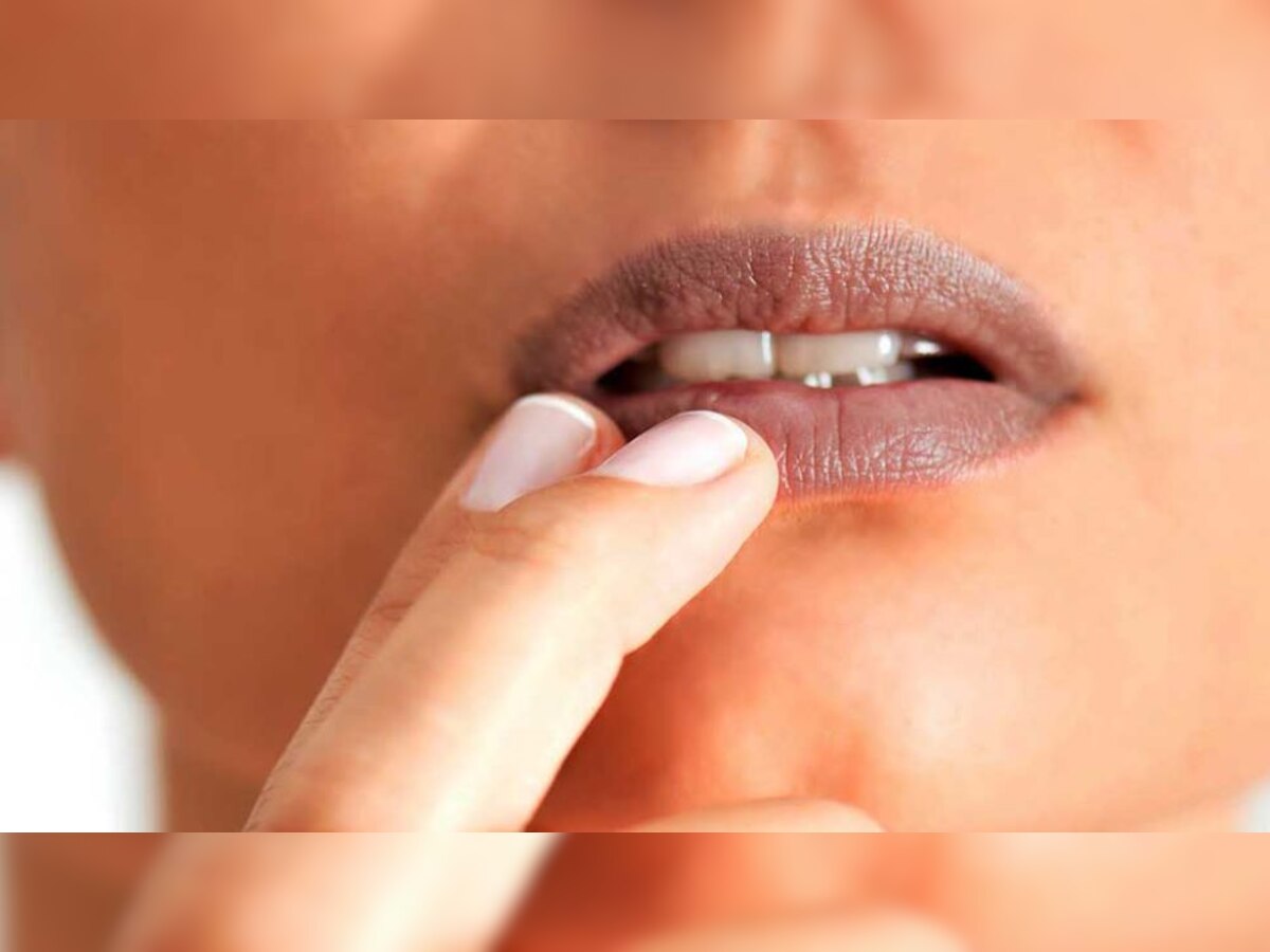 Lips Care Tips: आप भी हैं होंठों के कालेपन से परेशान? तो अपनाएं ये घरेलू उपाय