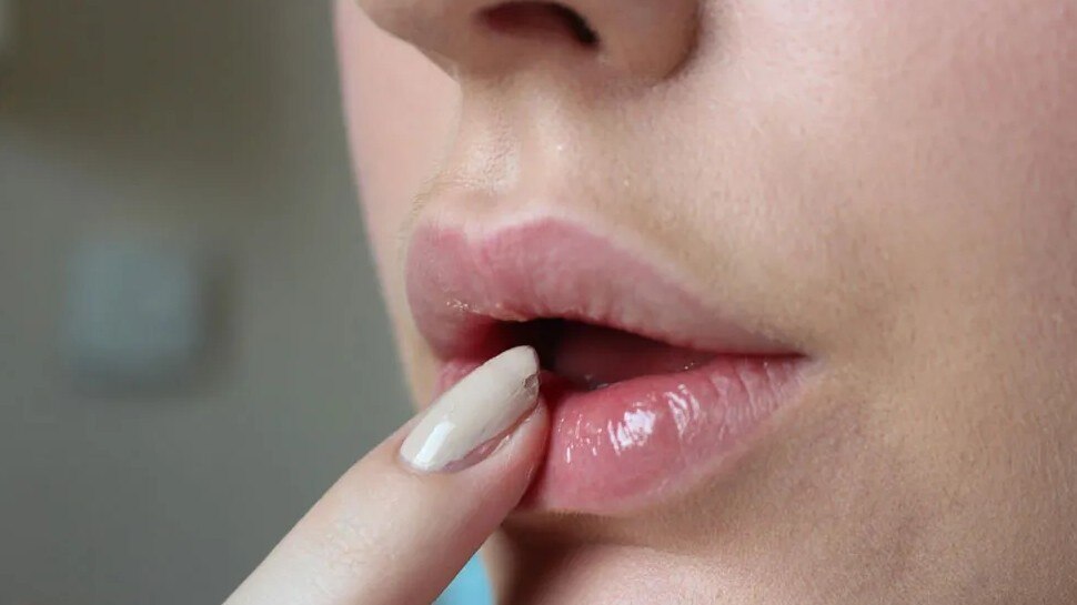 try-these-tips-to-remove-dark-circles-around-the-lips-due-to