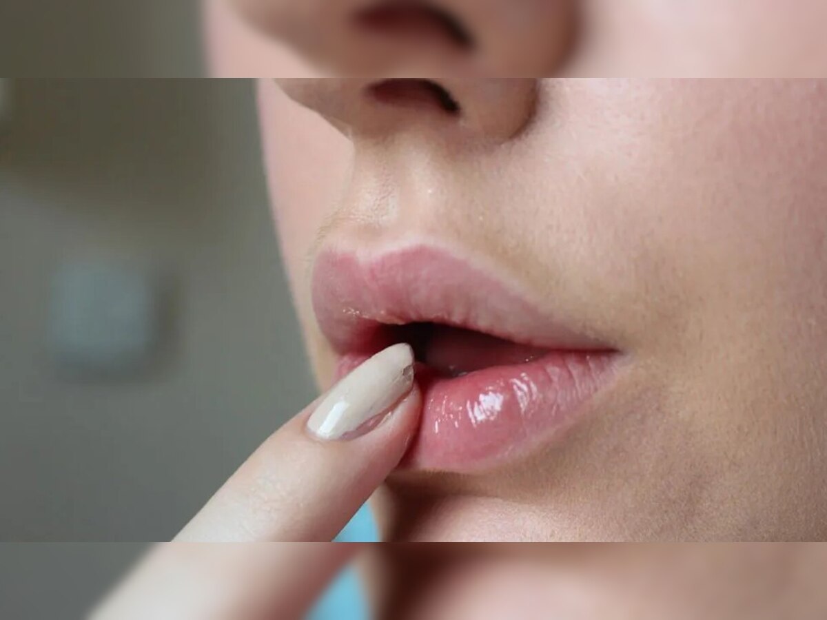 Lip Care: हाइपरपिग्मेंटेशन के कारण होंठों के आसपास हो जाते हैं काले घेरे, बस ट्राई करें ये टिप्स  