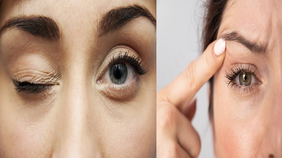 Eye twitching is not good or bad, but a sign of serious illnessKKRPH