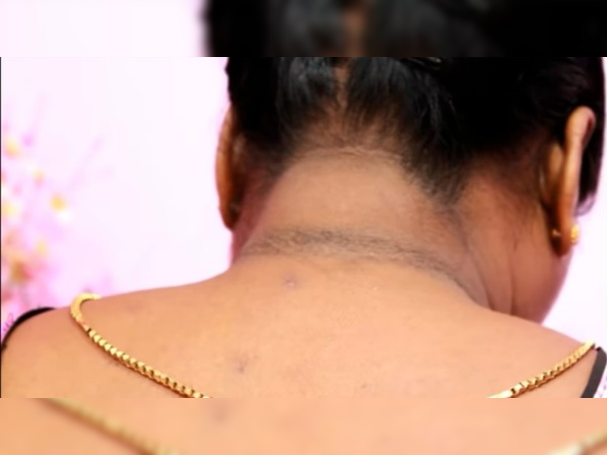 Dark Neck: टैनिंग से गर्दन पड़ गई है काली, तो अपनाएं ये टिप्स; चेहरे की तरह चमकने लगेगी!