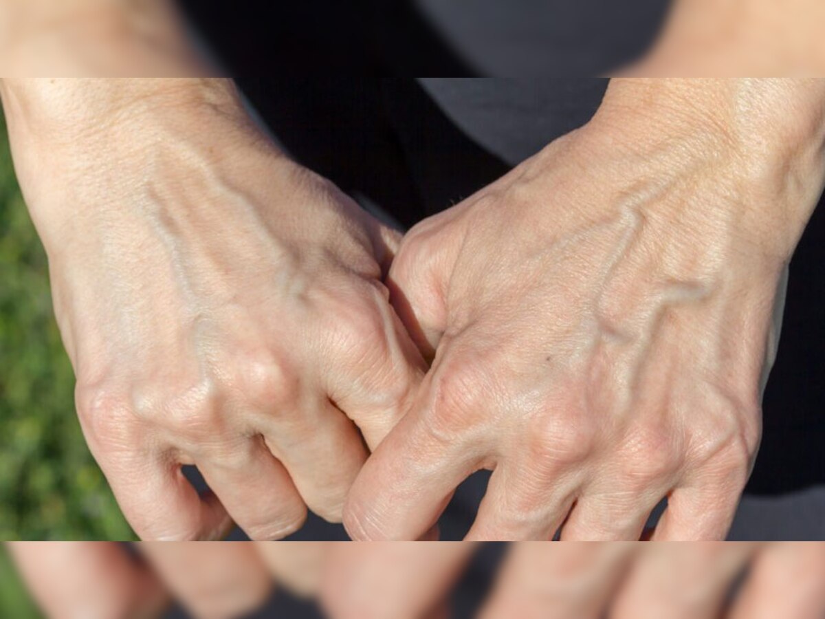 Hand Veins: आखिर क्यों दिखाई देती हैं हाथों की नसें? यहां जान लीजिए इसके पीछे की वजह