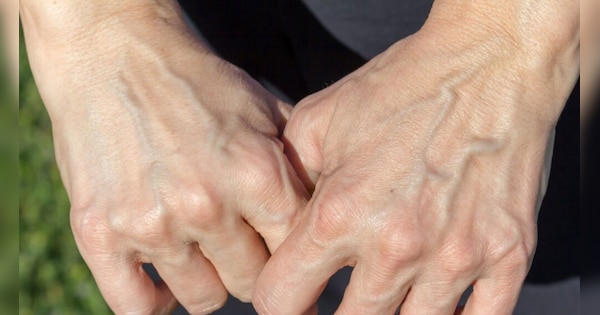 Why are the veins of the hands visible Know here the reason behind it |  Hand Veins: आखिर क्यों दिखाई देती हैं हाथों की नसें? यहां जान लीजिए इसके  पीछे की वजह |