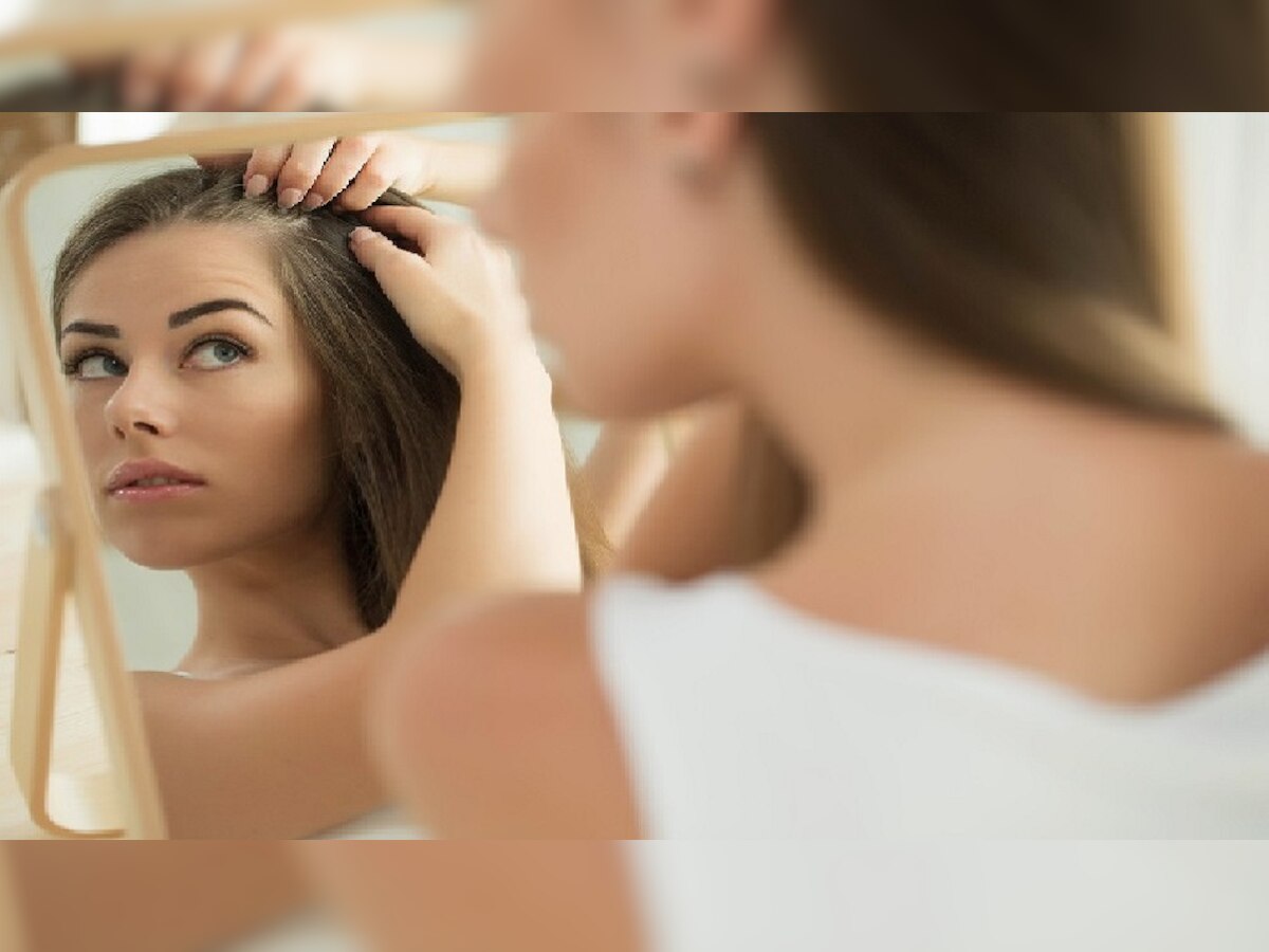 Hair Care Remedies: झड़ते बालों से हैं परेशान तो लहसुन आएगा काम, बस इस तरीके से करें इस्‍तेमाल 