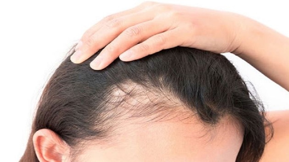Ayurvedic Remedies for Hair Loss: इन आयुर्वेदिक तरीकों से करें बालों की देखभाल, हेयर फॉल से मिलेगा छुटकारा