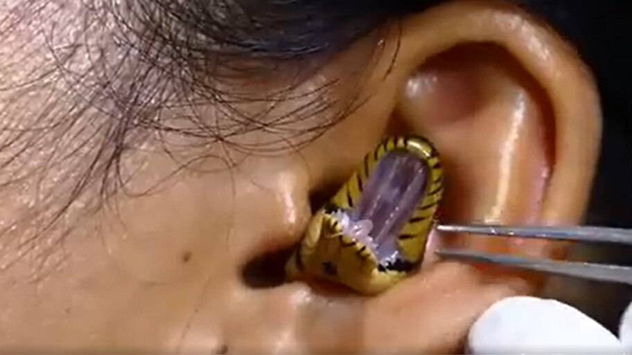 Snake Video: small snake inside the ear shocking footage viral on ...