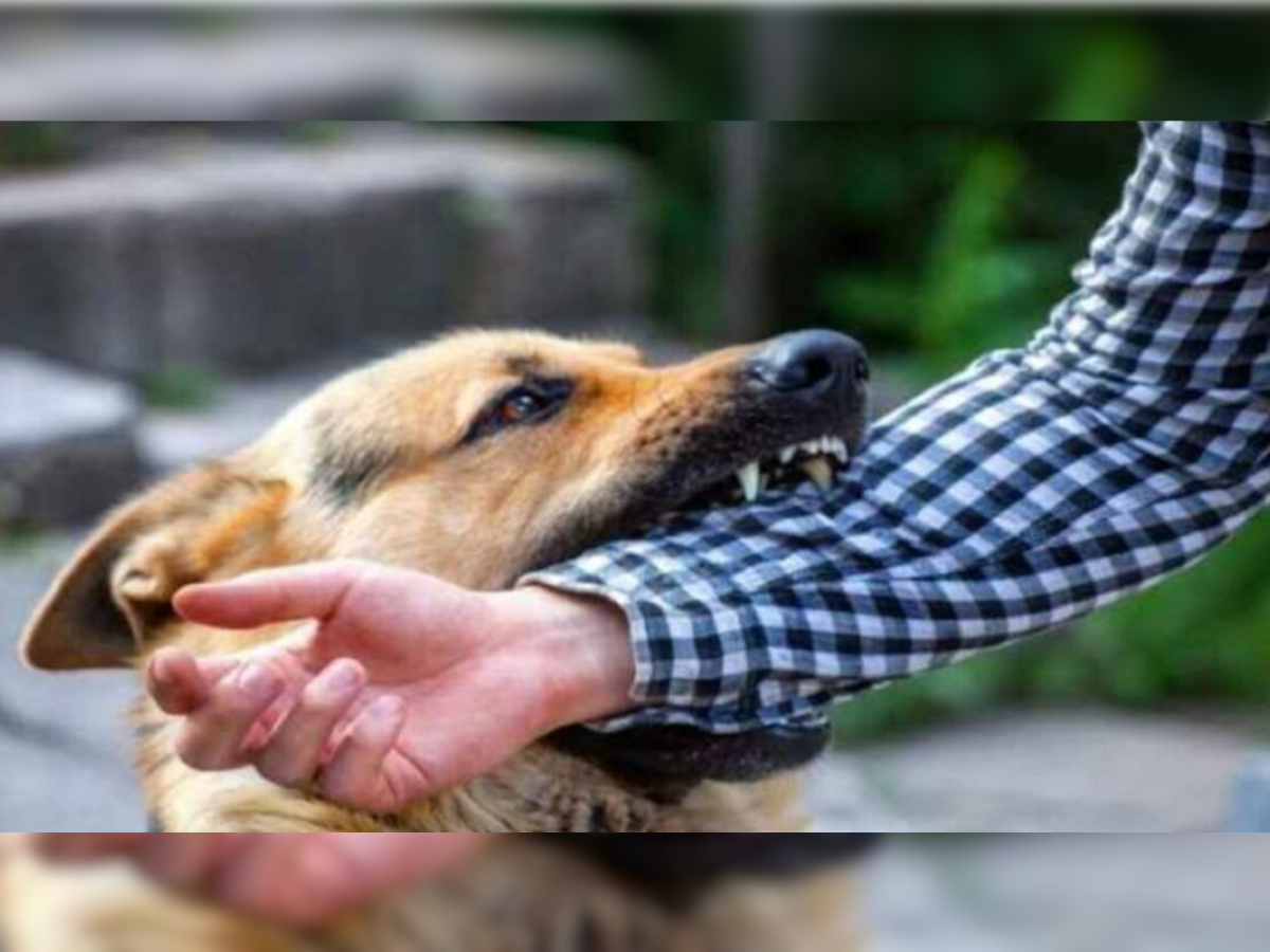 Dog Bite: कुत्ता काट ले तो तुरंत करें ये 3 काम, नहीं तो हो जाएगी यह बीमारी, 6 दिन में छिन जाएगी सांसों की डोर!