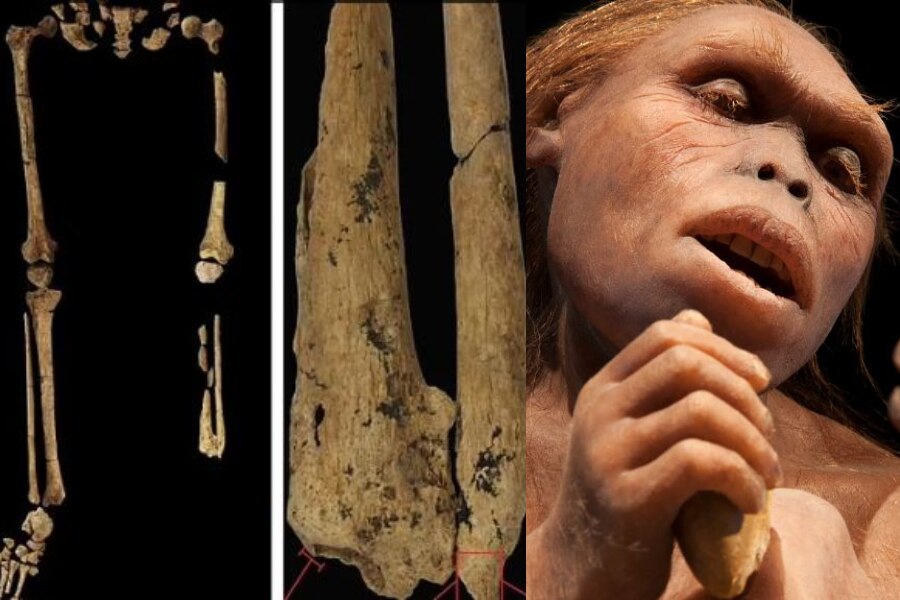 30,000 साल पहले गुफाओं में इंसान ने की थी अंगच्छेद सर्जरी, बच गई थी मरीज की जान