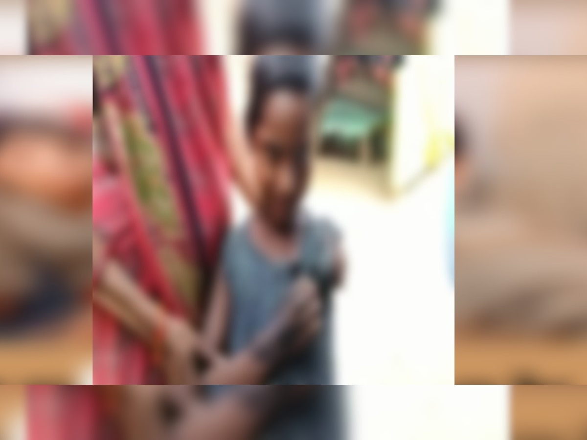 बाराबंकी: दलित दिव्यांग छात्रा के हाथ पर डाल दी खौलती सब्जी, परिजनों ने प्रधानाध्यापक पर लगाए गंभीर आरोप