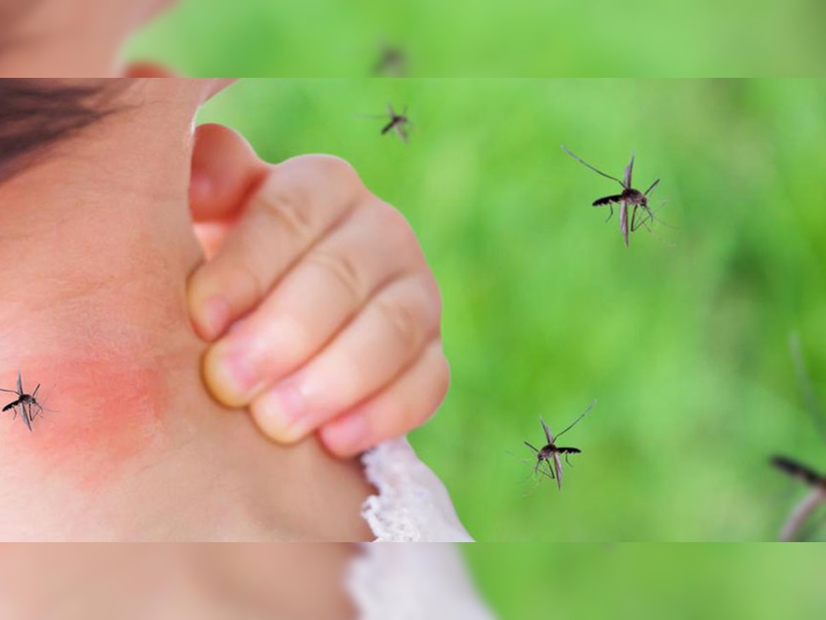 Mosquitoes Home Remedies: मच्छरों के प्रकोप से हैं परेशान, कर लें ये 4 घरेलू उपाय; तुरंत मिल जाएगी राहत