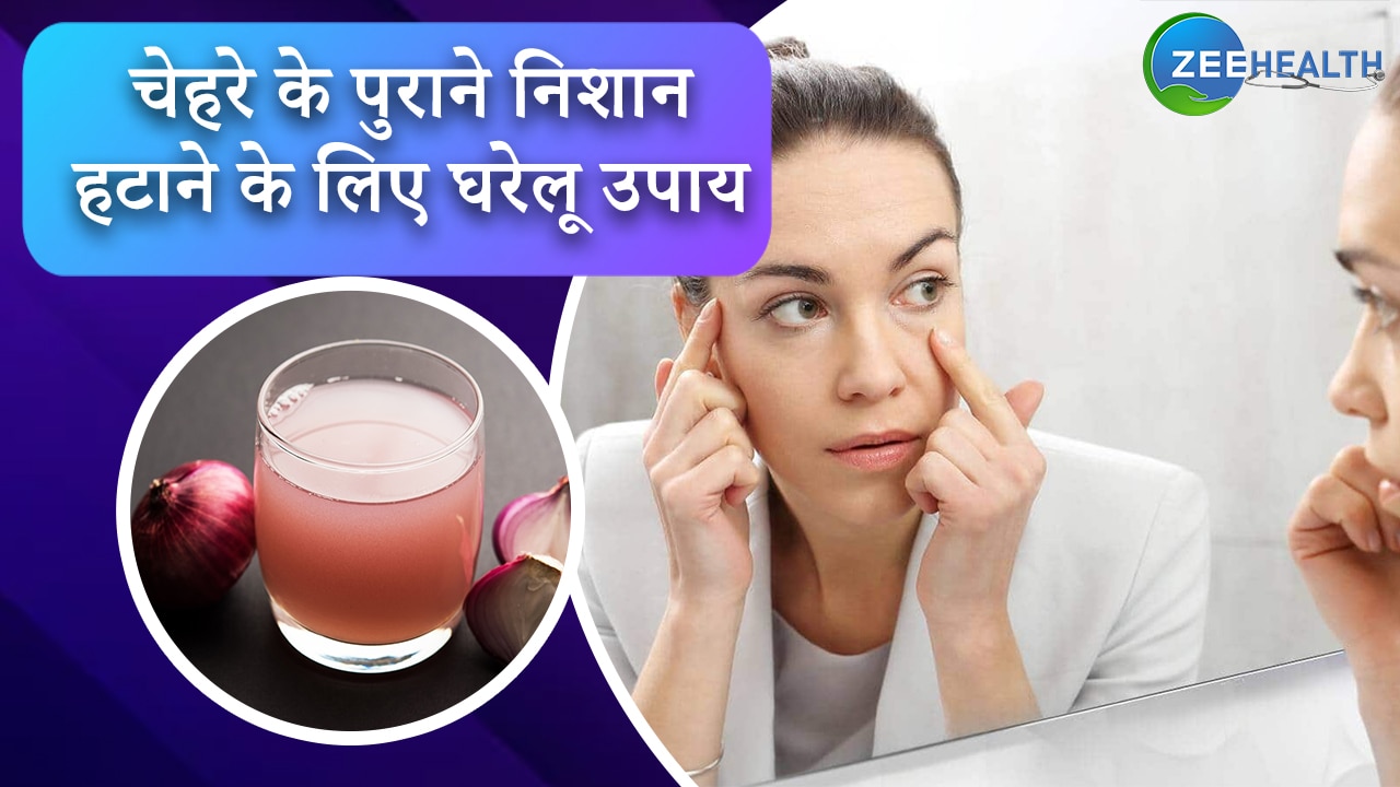 old scars and injury marks on the face can be removed from these home