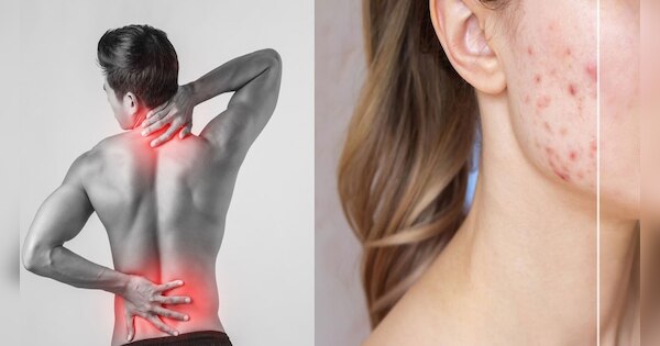 know-here-how-to-increase-vitamin-d-naturally-vitamin-d