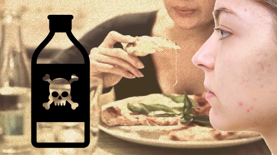 Unhealthy food for skin acne stop eating these 7 foods for menten face ...