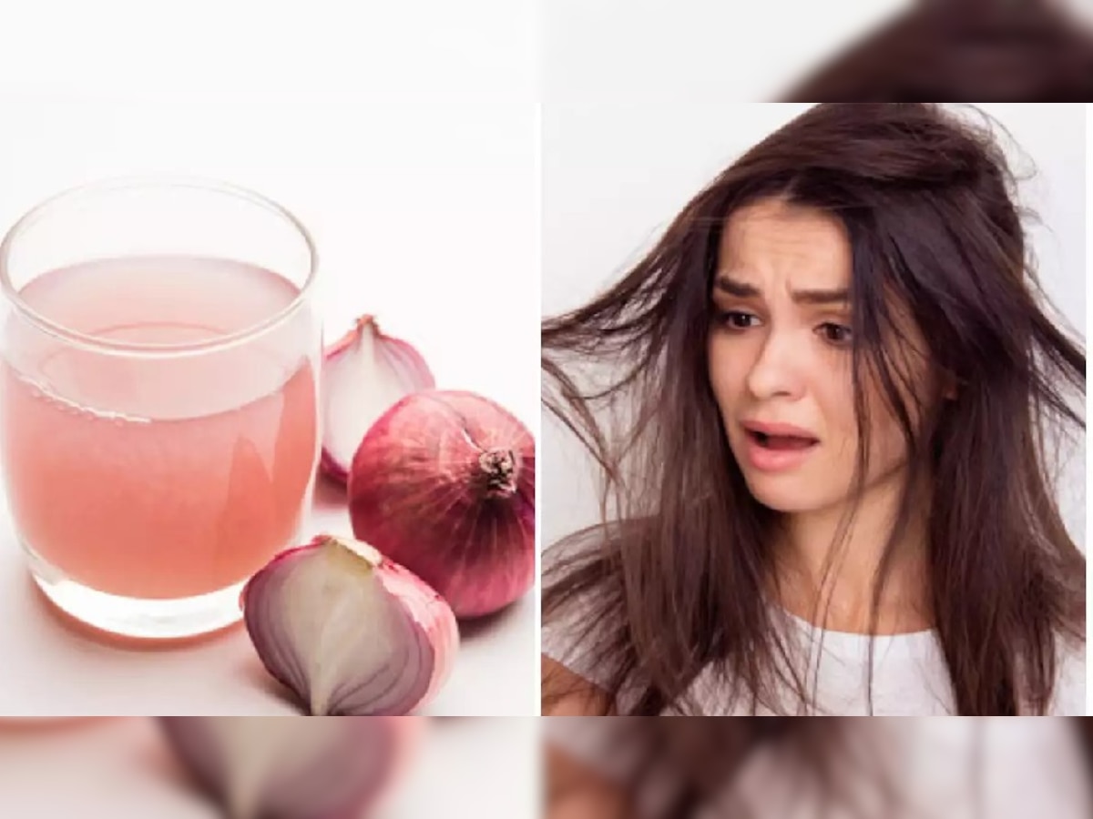 Hair Mask For Growth Hair fall Fenugreek Onion cinnamon Banana Honey Coconut Oil Baldness