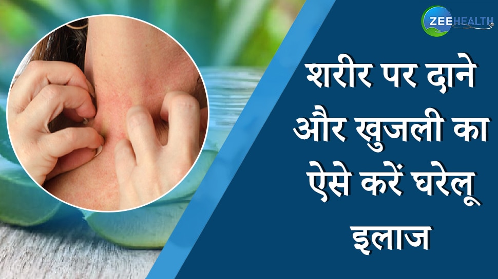 treat with these home remedies if rashes and itching on skin nsmp