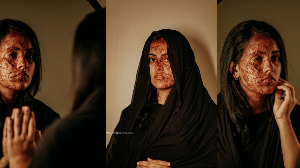 एसिड अटैक पर मेकओवर फोटोग्राफी