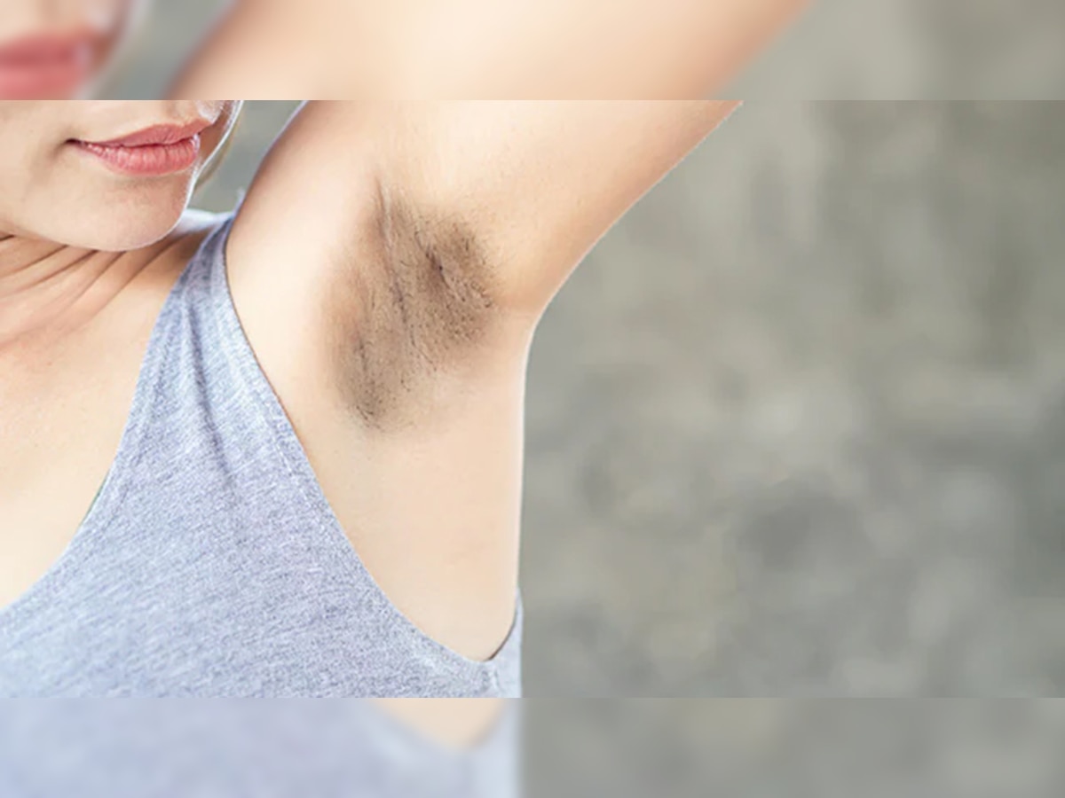 Dark Underarms: नींबू में हल्दी मिलाकर लगाएं ऐसे, जानें डार्क अंडरआर्म्स को चमकाने के गजब तरीके