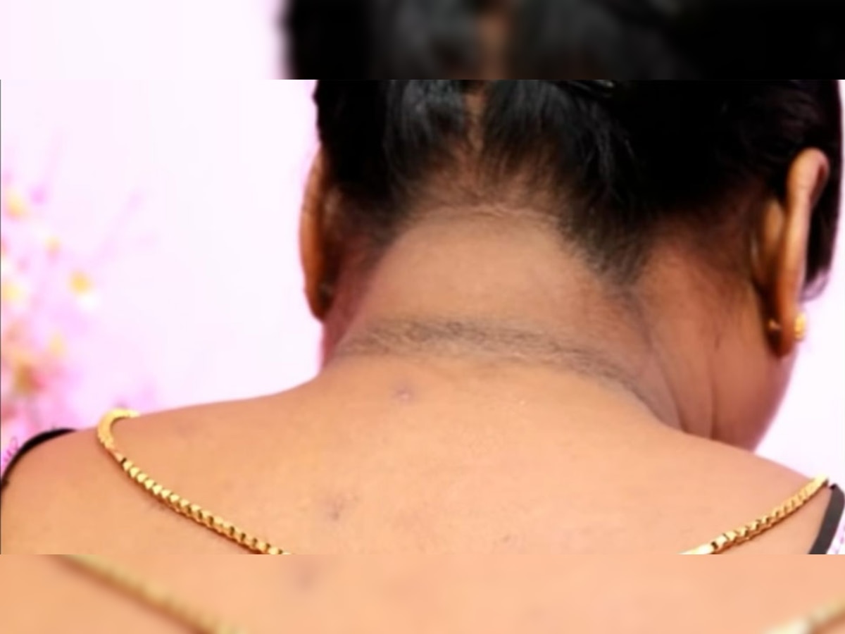 Neck Tan: टैनिंग से काली पड़ गई है गर्दन, तो घर बैठे बस करें ये काम; पलभर में आ जाएगा निखार