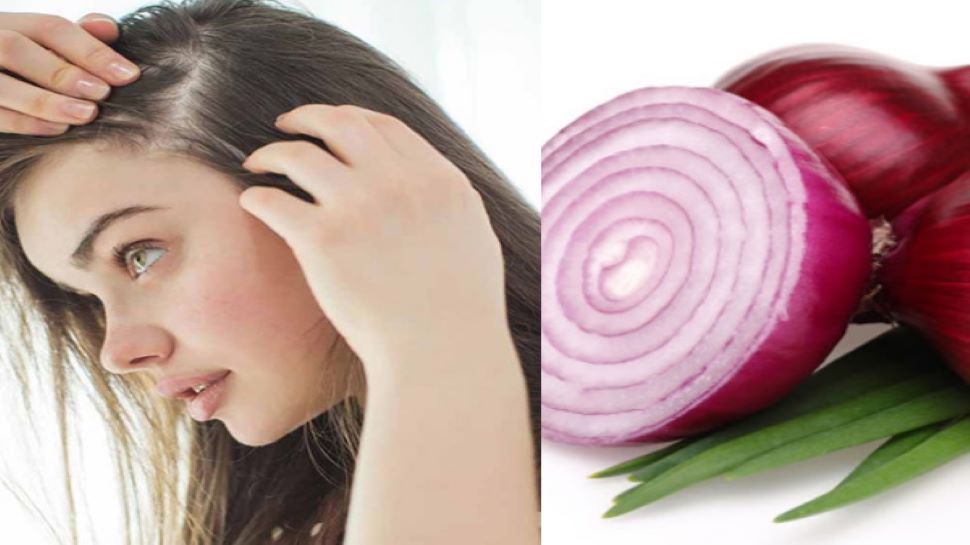 hair care tips onion juice will have white hair black Hair Care Tips