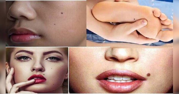 Mole On Body mole in this part of body is lucky | Mole On Body: अगर