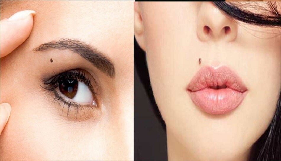 Meaning of Mole on these body parts is considered lucky such people are