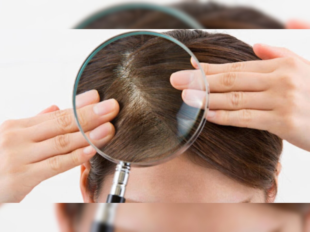 Thin Hair Tips: अगर बाल हो गए हैं पतले, तो आज ही छोड़ दें ये आदतें, होगा फायदा