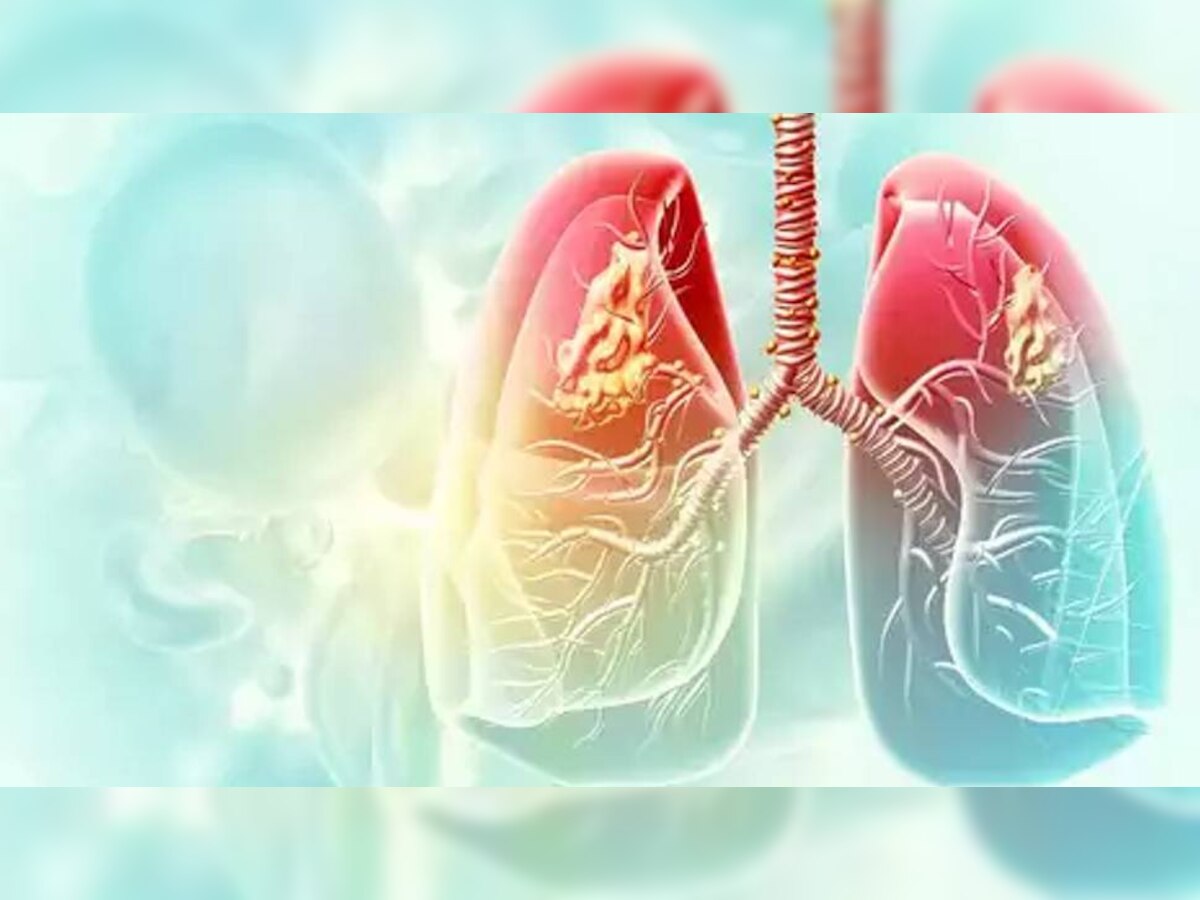 World Lung Day 2022: ऐसे रखें फेफड़ों को सेहतमंद