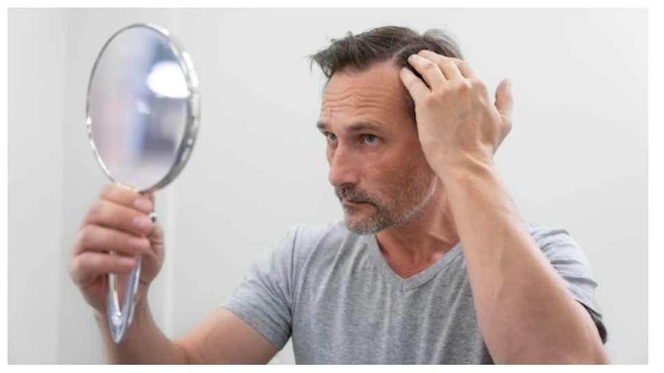 Grey Hair Problem In Young Age White Hair Causes And Cure Grey Hair 