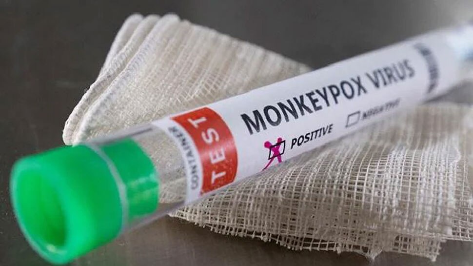 Monkeypox: देश में कोरोना के बाद मंकीपॉक्स बढ़ा रहा चिंता, राजधानी दिल्ली में फिर बढ़े मामले