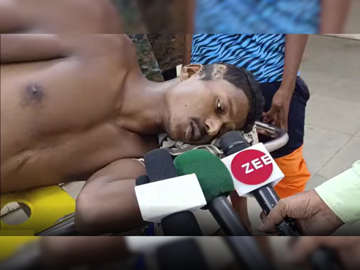 Odisha Labor Torture: ବିଶ୍ୱସ୍ତରୀୟ ରାଜ୍ୟରେ ଦାଦନ ଦୁଃଖ, ମଜୁରୀ ମାଗିବାରୁ ଆଦିବାସୀ ଯୁବକର ହାତ ଓ ଗୋଡ଼ କାଟି ଦେଲେ ଦଲାଲ