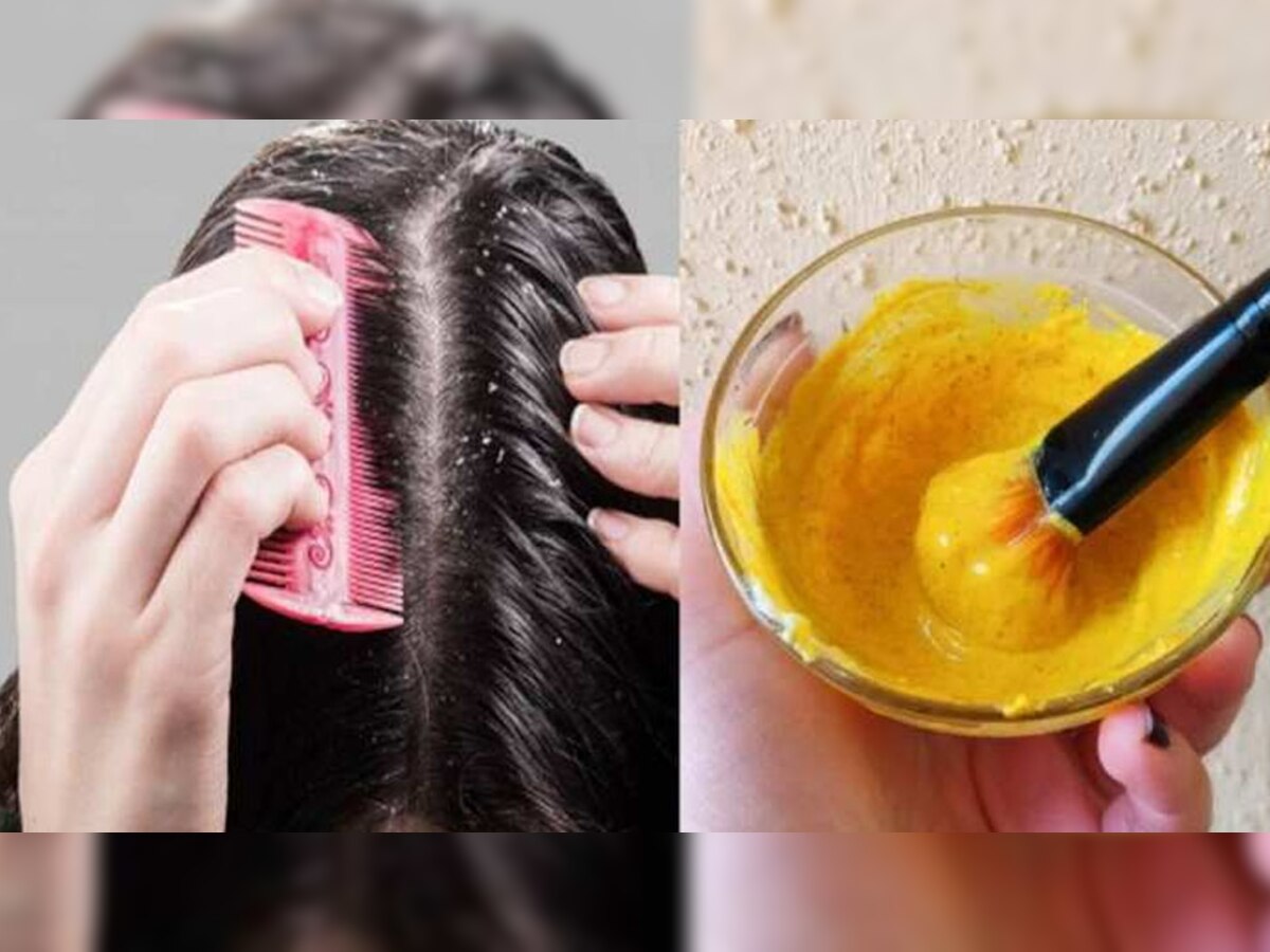 Ayurvedic Hair Care Tips: बालों के झड़ने से परेशान हैं? अपना लें ये 3 आयुर्वेदिक टिप्स, जल्द दिखाई देने लगेगा असर