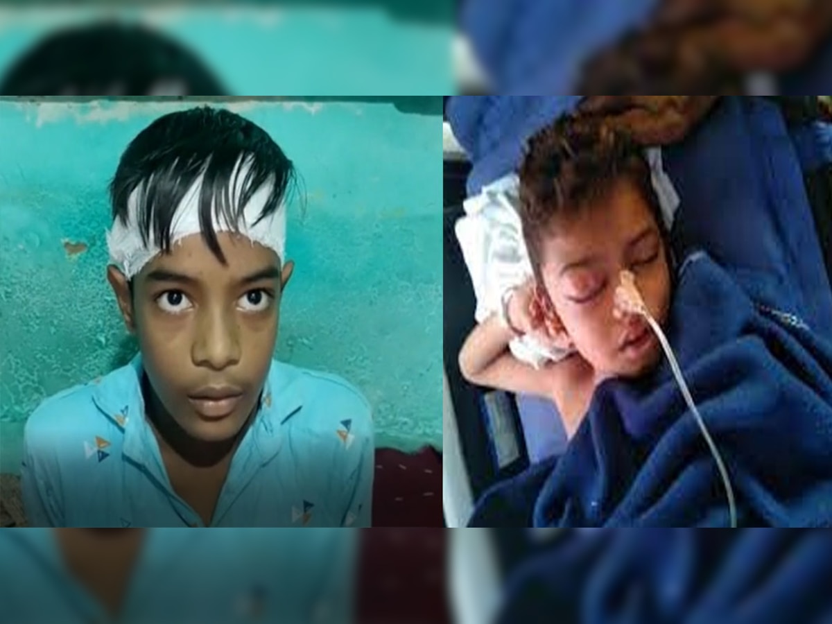 जालोर के स्कूली बच्चे की मौत के बाद अब झुंझुनूं में लेट आने पर बच्चे का फोड़ा सिर, प्रिंसिपल पर आरोप