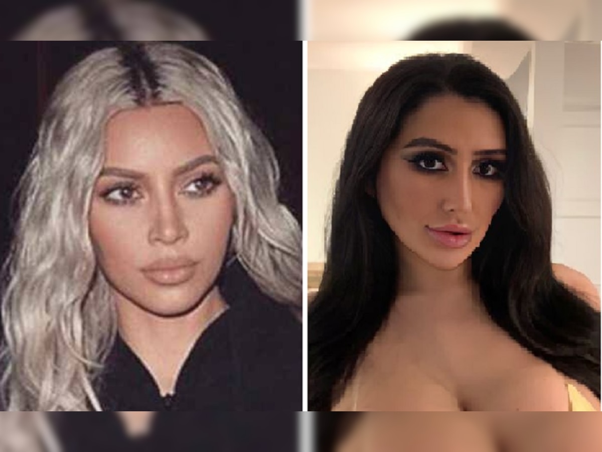 Kim Kardashian: किम कार्दशियन जैसा दिखने के लिए लड़की ने कराई 15 बार सर्जरी, लेकिन हो गया ये हाल