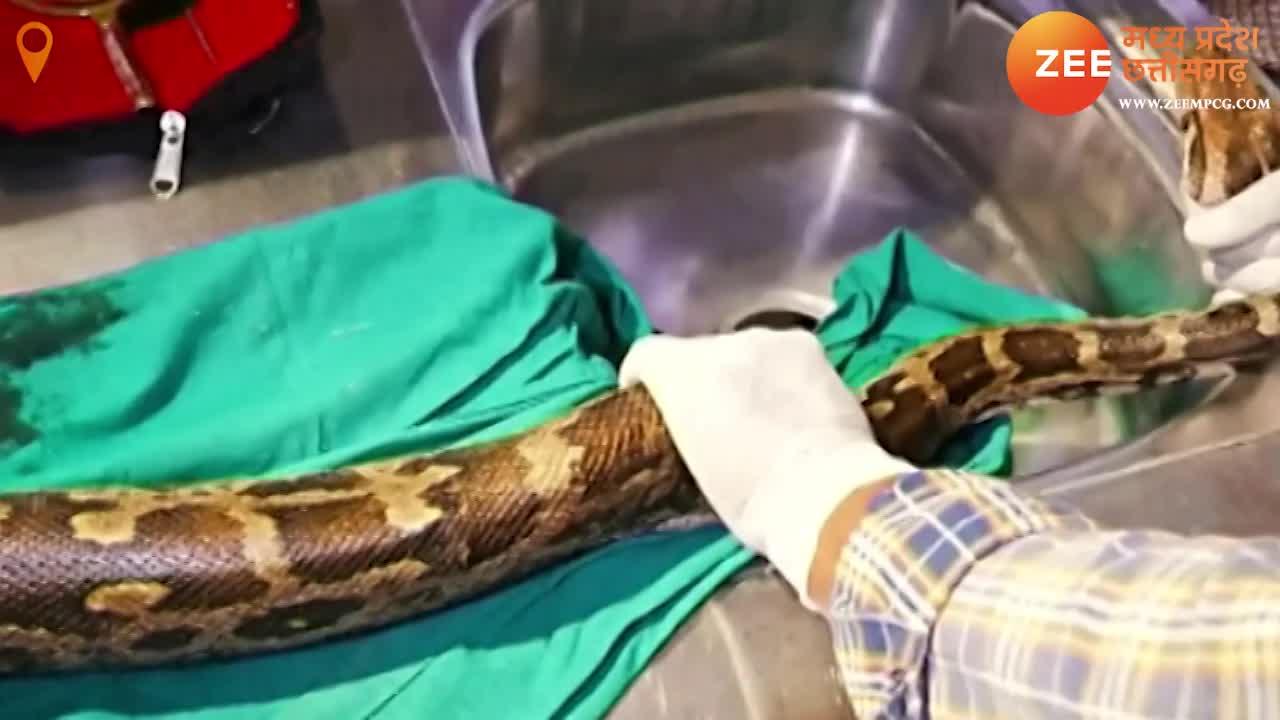 python stomach operation done in chhindwara doctors did surgery ajgar ...
