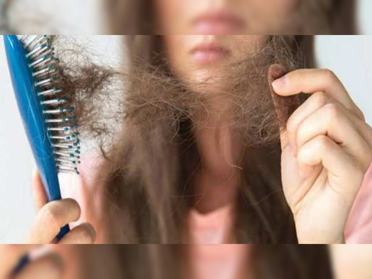 Hair Loss Treatment: झड़ रहे हैं बाल तो अपनाएं आंवले से बना ये रामबाण नुस्खा