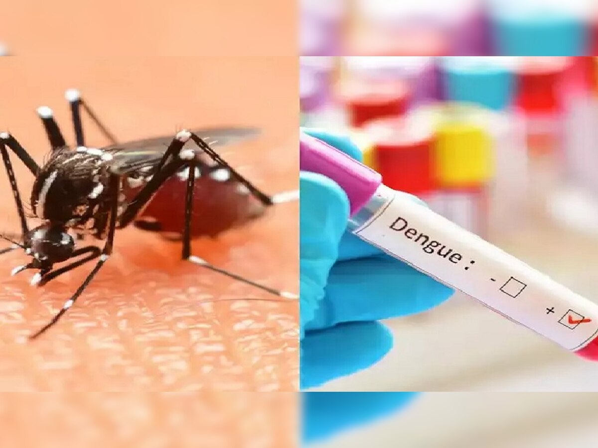 Dengue In Patna: पटना में तेजी से फैल रहा डेंगू, हड्डी तोड़ बुखार से ऐसे करें बचाव