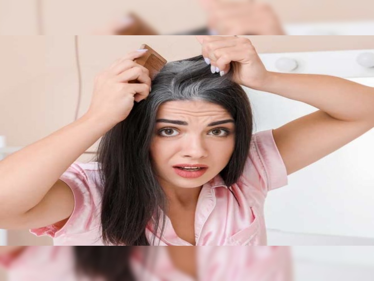 Hair Care Tips: White Hair से हैं परेशान? तो बालों में लगाएं आंवले से बना ये हेयर पैक, 2 दिन में बाल होंगे काले