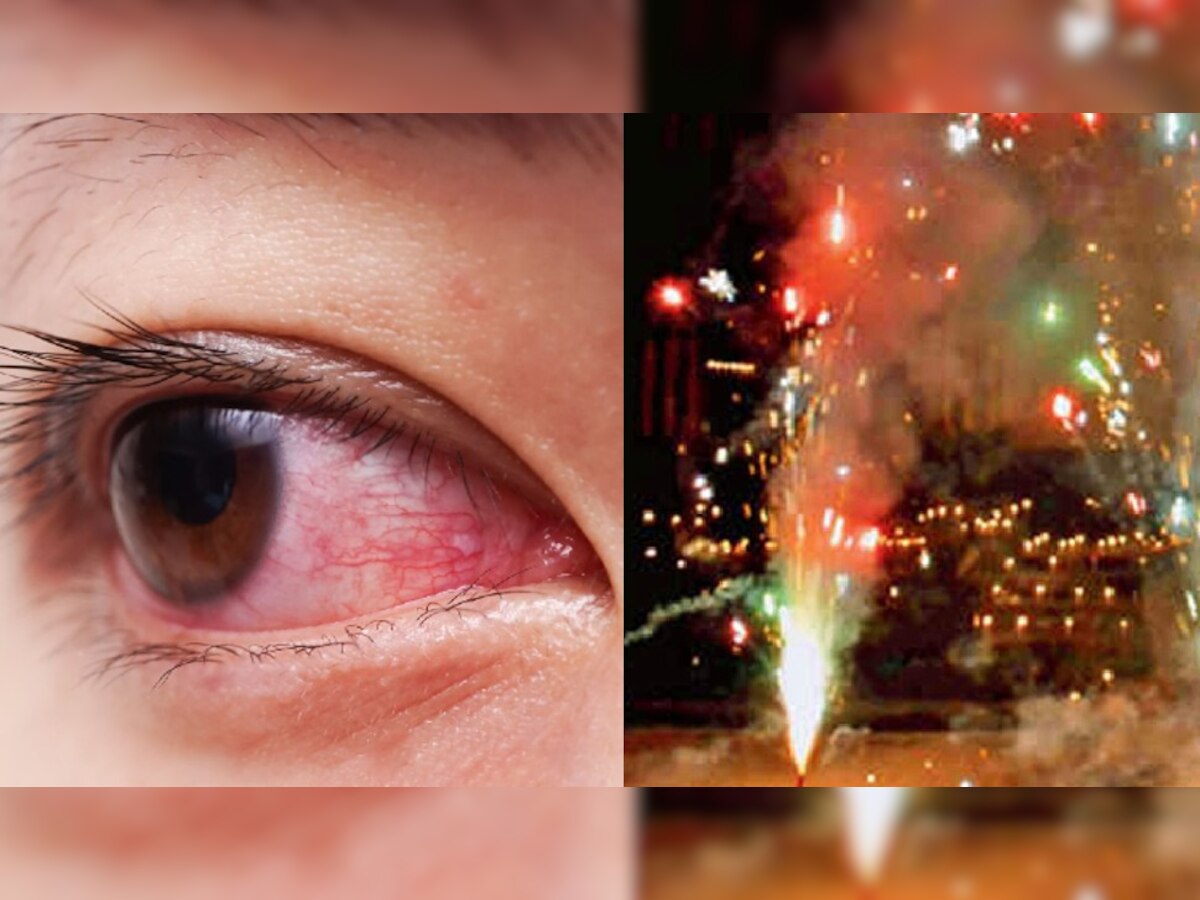Diwali 2022: पटाखों के प्रदूषण से होने लगती है आंखों में जलन और खुजली, तो ऐसे रखें सुरक्षित 