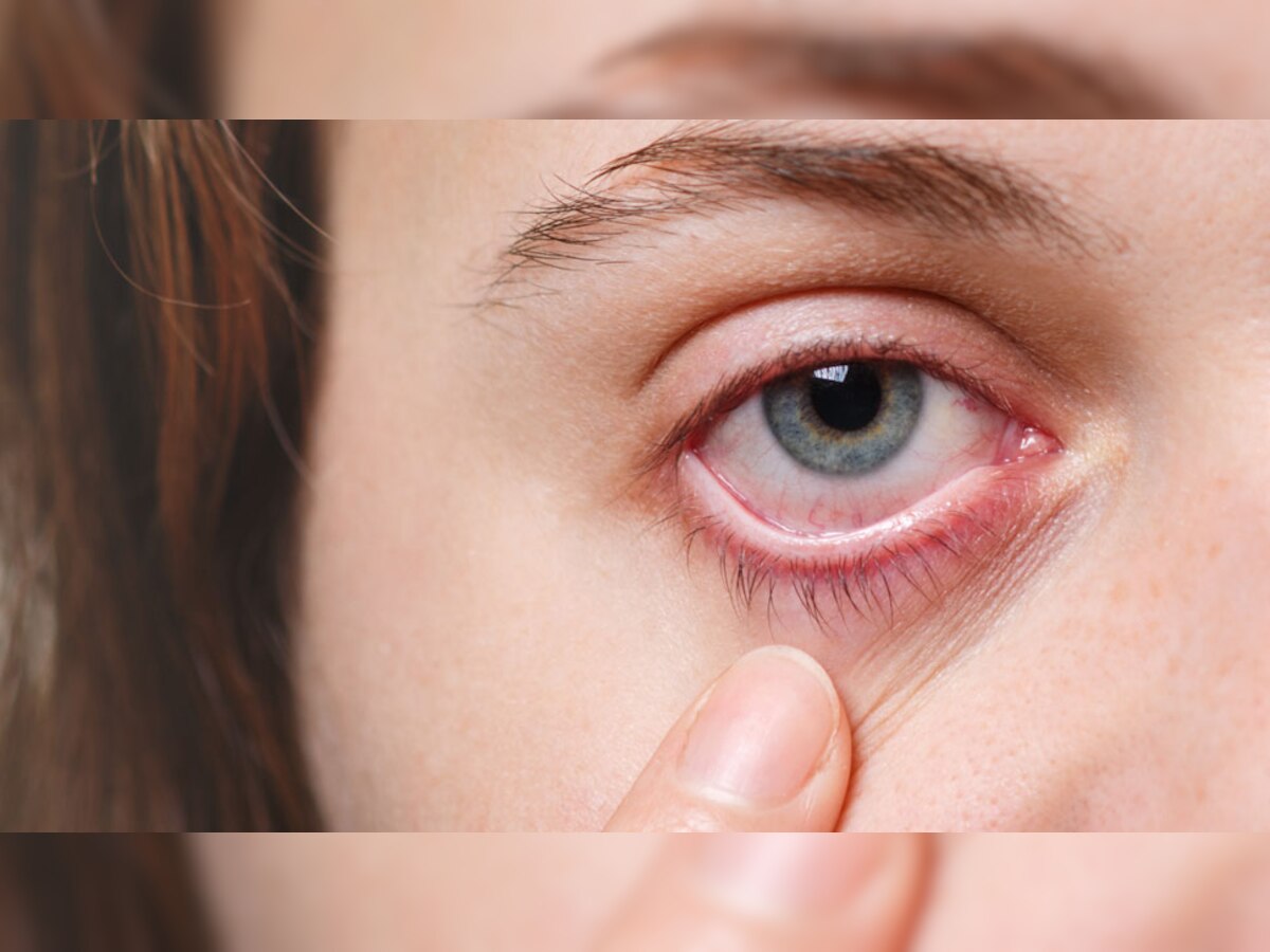 Dry Eye: आंखों में सूखने लगे आंसू तो हो जाएं अलर्ट, इन बड़ी परेशानियों का करना पड़ सकता है सामना