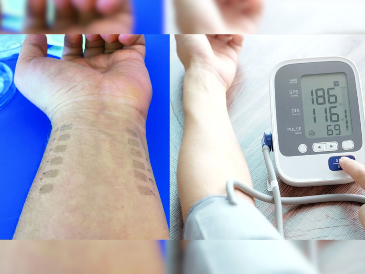 Blood Pressure Tattoo: अब मशीन कैरी करने की टेंशन खत्म, हाथों में चिपकाएं ब्‍लड प्रेशर नापने वाला टैटू