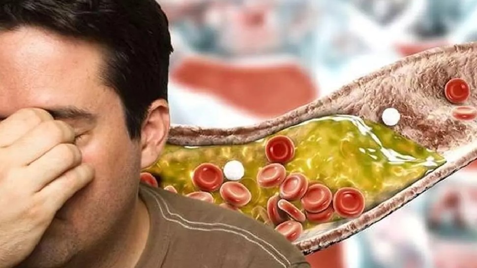 Bad Cholesterol: इस तरह मेंटेन करेंगे डाइट तो झट से कम होगा बैड कोलेस्ट्रॉल