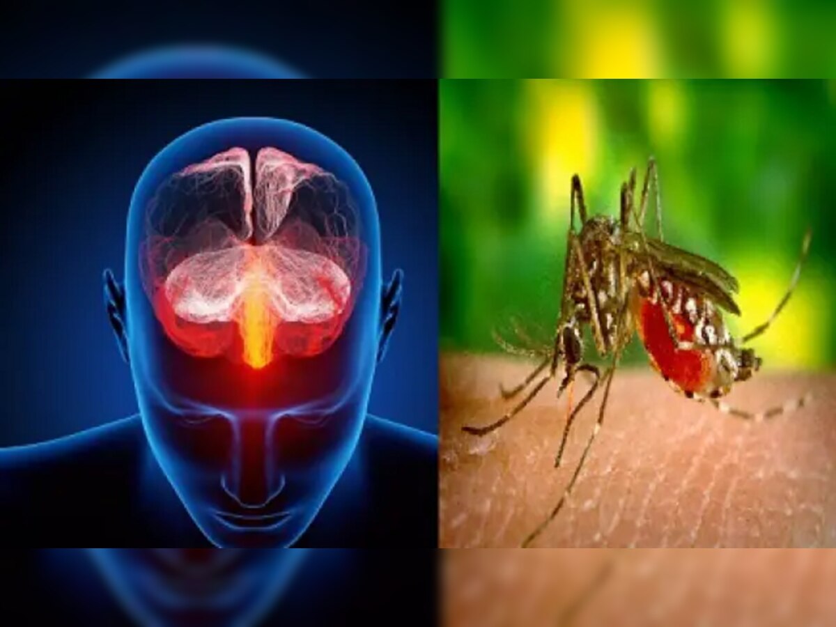 Brain Malaria: ମସ୍ତିଷ୍କ ମ୍ୟାଲେରିଆରେ ପୀଡ଼ିତ ହେଉଛନ୍ତି ଶିଶୁ, ଜାଣନ୍ତୁ ଲକ୍ଷଣ ଓ ପ୍ରତିଷେଧକ