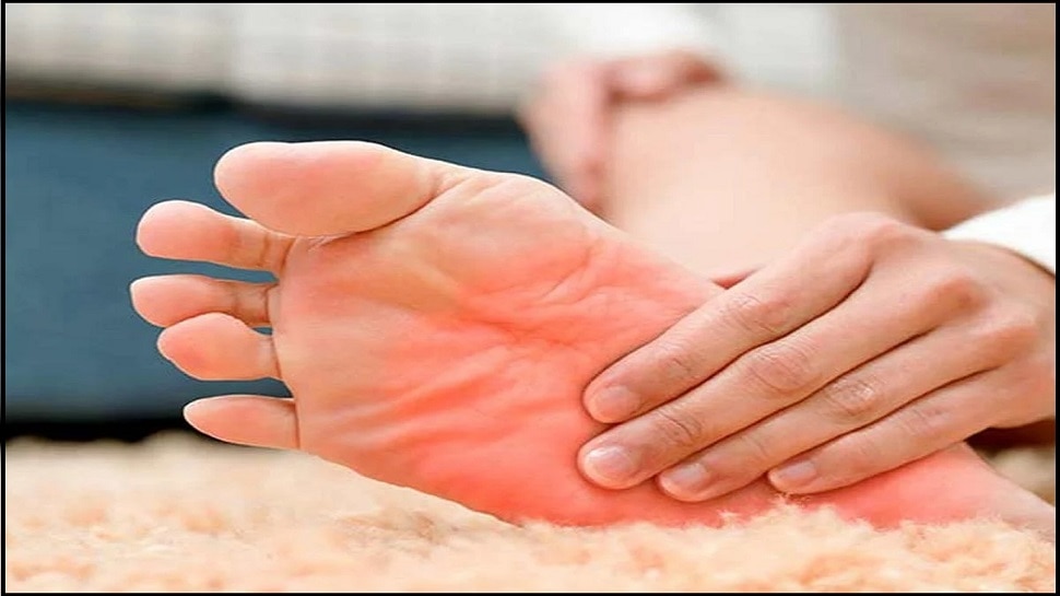 Health Tips Trouble by Feet Sole From Itching Burning Cause Of Burning