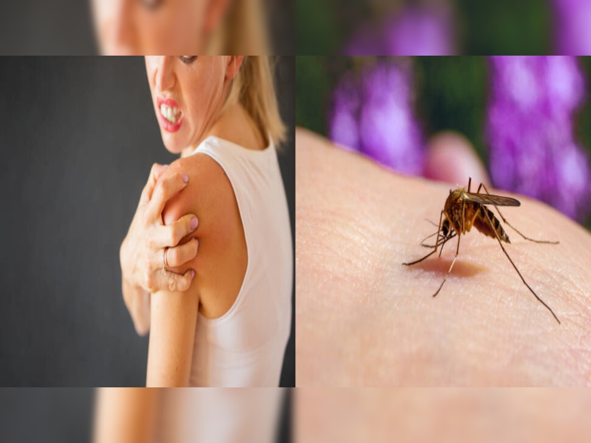 Mosquito Magnet: आखिर क्‍यों कुछ लोगों के पास खिंचे चले आते हैं मच्‍छर,वैज्ञानिकों ने दिया ये जवाब  