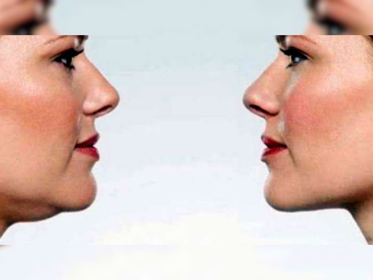 Reduce Face Fat: इन 3 कारणों से आता है चेहरे पर फैट; जानें कैसे जड़ से खत्म करें ये समस्या?