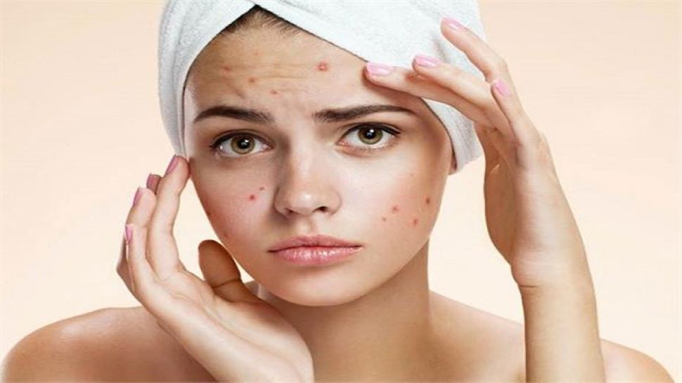 skin-care-tips-fix-old-injury-marks-in-these-ways-tips-to-remove-old