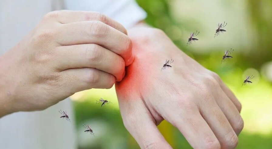 Mosquito Bite: कुछ लोगों को ज्यादा काटते हैं मच्छर, जानिए इसके पीछे का अहम कारण